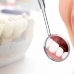 Top Dental Treatments Available in Swindon to Enhance Your Smile
