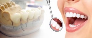 Top Dental Treatments Available in Swindon to Enhance Your Smile